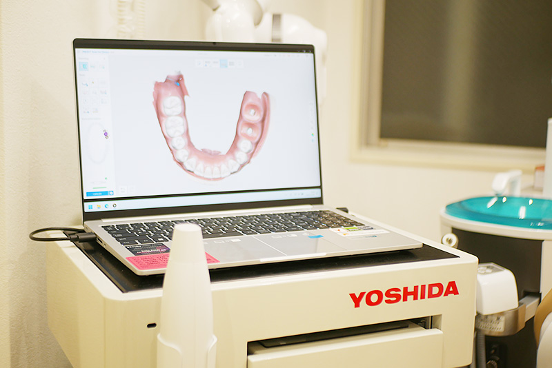 3D光学スキャナー